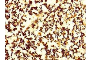 Immunohistochemistry of paraffin-embedded human appendix tissue using ABIN7165176 at dilution of 1:100 (CNPY4 Antikörper  (AA 22-248))