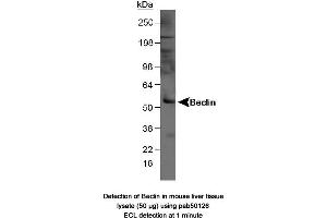 Image no. 1 for anti-Beclin 1, Autophagy Related (BECN1) antibody (ABIN363435) (Beclin 1 Antikörper)