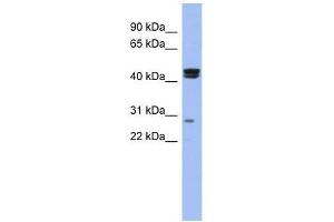 HSFY1 antibody used at 0. (HSFY1 Antikörper  (N-Term))