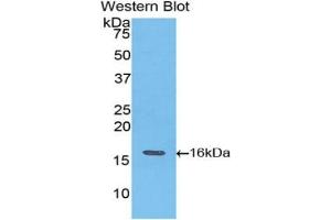 Western blot analysis of the recombinant protein. (TNNT3 Antikörper  (AA 147-269))