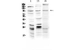 Western blot analysis of Semaphorin 3A using anti-Semaphorin 3A antibody . (SEMA3A Antikörper  (AA 21-223))