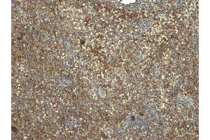 Immunohistochemistry (IHC) image for anti-Myeloid Differentiation Primary Response Gene (88) (MYD88) (Internal Region) antibody (ABIN185362)