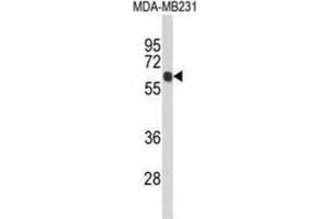 Western Blotting (WB) image for anti-Ankyrin Repeat Domain 13C (ANKRD13C) antibody (ABIN3004051) (ANKRD13C Antikörper)