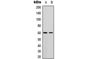 Western blot analysis of AKT expression in MCF7 (A), NIH3T3 (B) whole cell lysates. (AKT1 Antikörper  (Center))