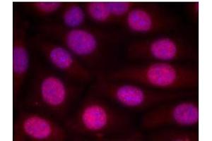 Image no. 3 for anti-Estrogen Receptor 1 (ESR1) (Ser118) antibody (ABIN197218) (Estrogen Receptor alpha Antikörper  (Ser118))