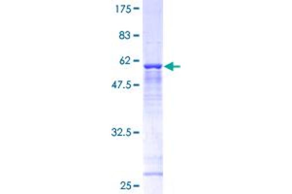 TBCB Protein (AA 1-244) (GST tag)