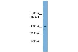 WB Suggested Anti-Acd Antibody Titration:  0.