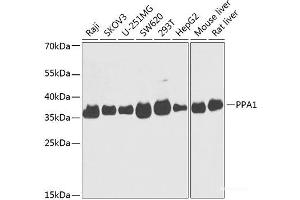 Western blot analysis of extracts of various cell lines using PPA1 Polyclonal Antibody at dilution of 1:1000.