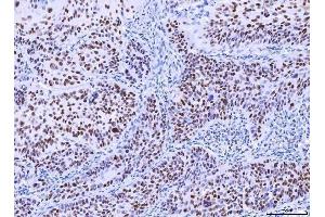 IHC analysis of MSH2 using anti-MSH2 antibody (ABIN7601369). (MSH2 Antikörper  (AA 337-583))