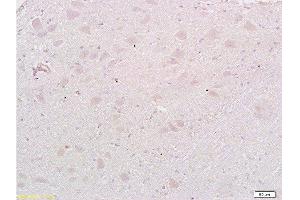 Formalin-fixed and paraffin embedded: rat brain tissue labeled with Anti-MAP1A Polyclonal Antibody , Unconjugated at 1:200, followed by conjugation to the secondary antibody and DAB staining (MAP1A Antikörper  (AA 2651-2750))