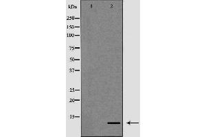 Western blot analysis of K562 cell lysate, using S100A12 Antibody. (S100A12 Antikörper)