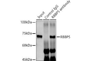 Immunoprecipitation analysis of 300 μg extracts of MCF7 cells using 3 μg RBBP5 antibody (ABIN6128620, ABIN6146741, ABIN6146742 and ABIN6222719). (RBBP5 Antikörper  (AA 319-538))