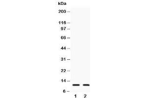 Western blot testing of Eotaxin 3 antibody and Lane 1:  COLO320