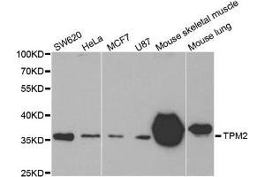 Western Blotting (WB) image for anti-Tropomyosin-2 (TPM2) antibody (ABIN1875181)