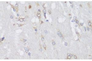 Immunohistochemistry of paraffin-embedded Rat brain using FA2H Polyclonal Antibody at dilution of 1:150 (40x lens). (FA2H Antikörper)