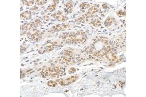 anti-RAN, Member RAS Oncogene Family (RAN) (AA 166-216) antibody