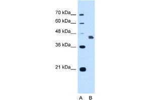 WB Suggested Anti-DFNA5 Antibody Titration:  1. (DFNA5 Antikörper  (C-Term))
