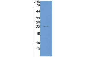 WB of Protein Standard: different control antibodies against Highly purified E. (PTGDS ELISA Kit)