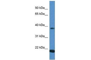 Western Blot showing IFNA13 antibody used at a concentration of 1 ug/ml against Placenta Lysate (IFNA13 Antikörper  (C-Term))