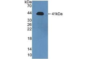 Detection of Recombinant PRH2, Human using Polyclonal Antibody to Acidic Salivary Proline Rich Phosphoprotein 2 (PRH2) (PRH2 Antikörper  (AA 17-166))