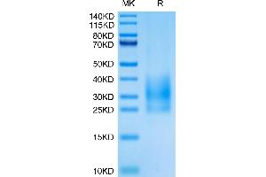 CD83 Protein (CD83) (AA 20-147) (His tag)