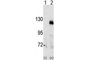 Western blot analysis of EphA3 antibody and 293 cell lysate either nontransfected (Lane 1) or transiently transfected with the EphA3 gene (2). (EPH Receptor A3 Antikörper  (AA 896-928))