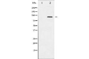 alpha Adducin Antikörper  (pSer726)