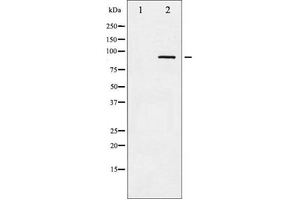 alpha Adducin Antikörper  (pSer726)