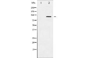 Western blot analysis of ADD1 phosphorylation expression in Forskolin treated HeLa whole cell lysates,The lane on the left is treated with the antigen-specific peptide. (alpha Adducin Antikörper  (pSer726))