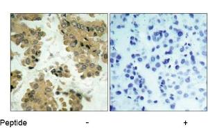 Image no. 1 for anti-V-Akt Murine Thymoma Viral Oncogene Homolog 2 (AKT2) (Ser474) antibody (ABIN197358) (AKT2 Antikörper  (Ser474))