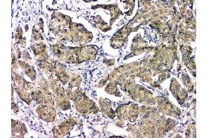 IHC analysis of EIF6 using anti-EIF6 antibody (ABIN6719594). (EIF6 Antikörper  (AA 66-210))