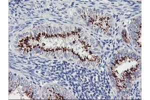 Image no. 6 for anti-Golgi Membrane Protein 1 (GOLM1) antibody (ABIN1498494) (GOLM1 Antikörper)