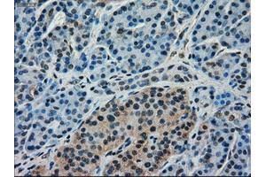 Immunohistochemical staining of paraffin-embedded pancreas tissue using anti-FERMT2mouse monoclonal antibody. (FERMT2 Antikörper)