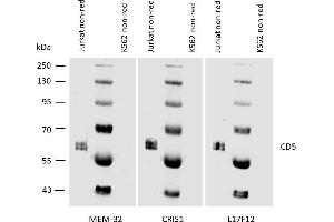 Western blotting analysis of human CD5 using mouse monoclonal antibodies MEM-32, CRIS1, and L17F12 on laurylmaltoside lysates of Jurkat cells and of K562 cells (negative control) under non-reducing conditions. (CD5 Antikörper)