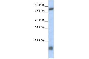 WB Suggested Anti-C21orf13 Antibody Titration:  0. (LCA5L Antikörper  (N-Term))