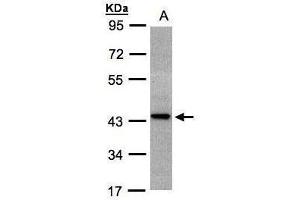 WB Image Sample(30 ug whole cell lysate) A:H1299 10% SDS PAGE antibody diluted at 1:1000 (ST3GAL2 Antikörper)