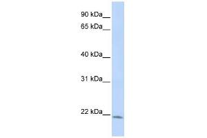 LIN7C antibody used at 1 ug/ml to detect target protein. (LIN7C Antikörper)
