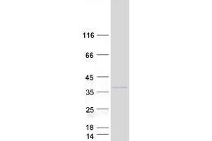 Western Blotting (WB) image for Pseudouridylate Synthase-Like 1 (PUSL1) protein (Myc-DYKDDDDK Tag) (ABIN2730192)