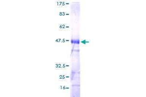 Image no. 1 for Ras Homolog Gene Family, Member J (RHOJ) (AA 1-214) protein (GST tag) (ABIN1318036) (RHOJ Protein (AA 1-214) (GST tag))