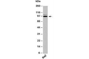Western blot testing of human samples with TRIL antibody at 2ug/ml. (TRIL Antikörper  (C-Term))