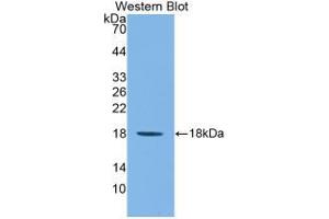 Western blot analysis of recombinant Mouse IL1F9. (IL1F9 Antikörper  (AA 5-149))