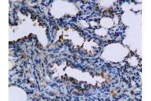 Formalin-fixed and paraffin embedded mouse lung labeled with Rabbit Anti-TNFSF15 Polyclonal Antibody, Unconjugated  followed by conjugation to the secondary antibody and DAB staining