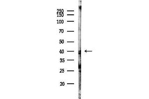 anti-RNA (Guanine-9-) Methyltransferase Domain Containing 1 (RG9MTD1) antibody