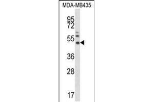 Western blot analysis in MDA-MB435 cell line lysates (35ug/lane). (MMP16 Antikörper  (N-Term))