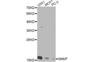 Western blot analysis of extracts of various cell lines, using MANF Antibody. (MANF Antikörper  (AA 25-182))