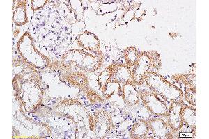 Immunohistochemistry (IHC) image for anti-Corticotropin Releasing Hormone Receptor 2 (CRHR2) (AA 51-150) antibody (ABIN680773)