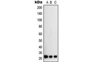 Western blot analysis of SOCS2 expression in K562 (A), A204 (B), PC12 (C) whole cell lysates. (SOCS2 Antikörper  (Center))