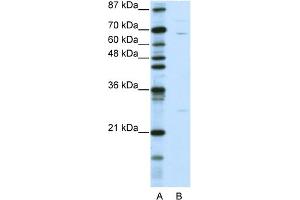 WB Suggested Anti-KLHL13 Antibody Titration:  0. (KLHL13 Antikörper  (N-Term))