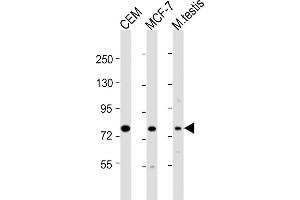 All lanes : Anti-MYBL2 Antibody (C-Term) at 1:8000 dilution Lane 1: CEM whole cell lysate Lane 2: MCF-7 whole cell lysate Lane 3: mouse testis lysate Lysates/proteins at 20 μg per lane. (MYBL2 Antikörper  (AA 540-571))