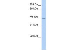 NEK6 antibody used at 1 ug/ml to detect target protein. (NEK6 Antikörper)